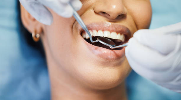 Best Emergency Broken Tooth Repair in High Ridge, MO